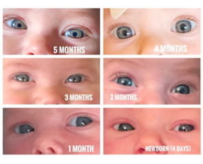baby's eyes
