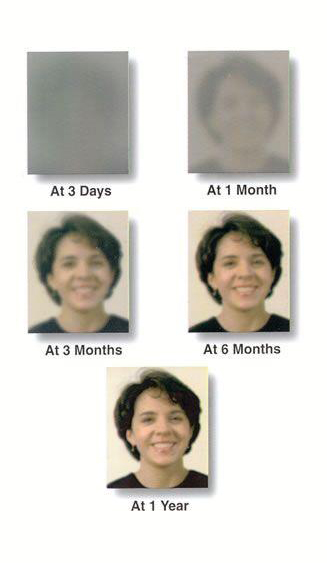 five picture from blurry to clear